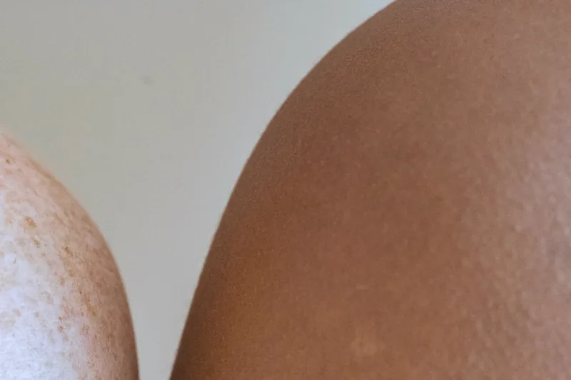 Two bare shoulders side by side in soft daylight, one pale and freckled, one dark brown
